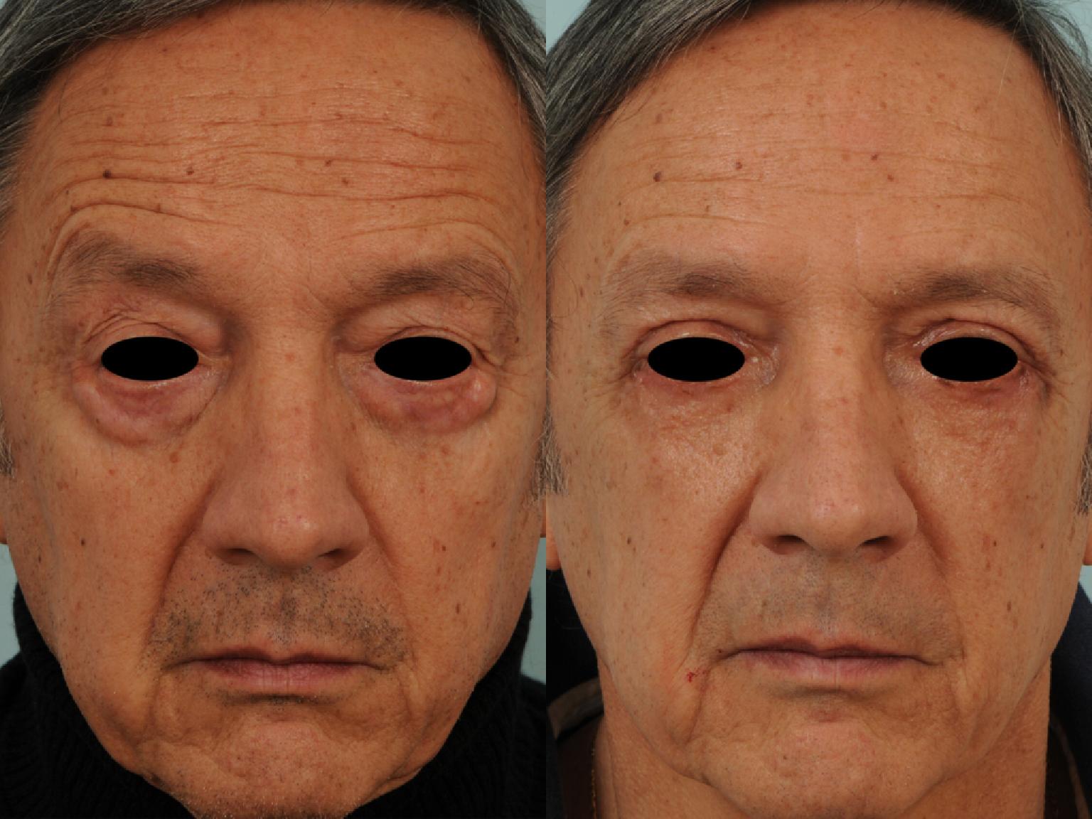 Short De Yoga Esthétique Avec Poches Pour Femme, Blanc, Taille L