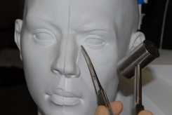 Traditional Rhinoplasty