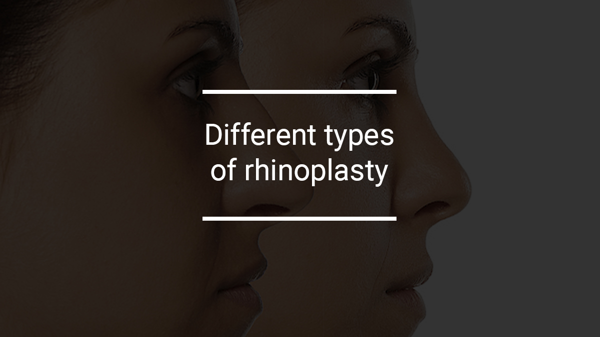 Different types of rhinoplasty
