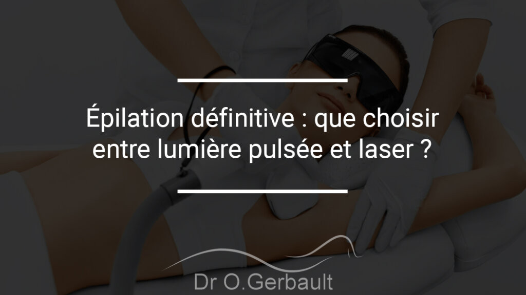 Épilation définitive que choisir entre lumière pulsée et laser